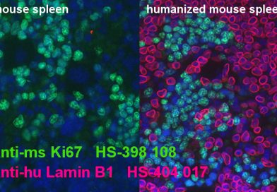 Monoclonal Rat Antibody Against Ki67