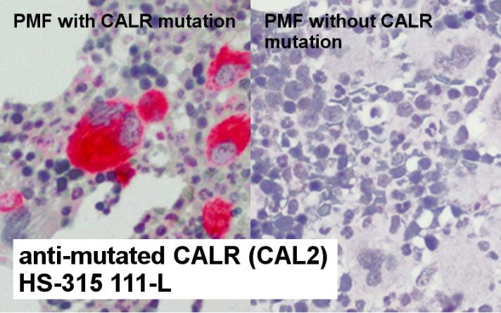 anti-mutated calreticulin (CALR) CAL2 antibody