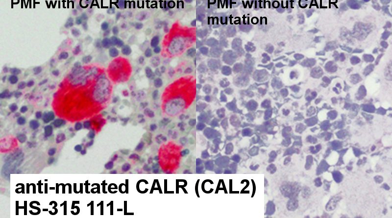 anti-mutated calreticulin (CALR) CAL2 antibody