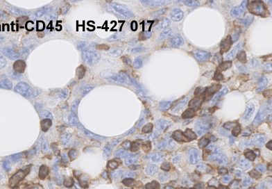 Anti-Mouse CD45 Antibody