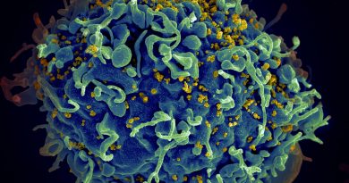 Moderna Starts HIV Vaccine Trial that Uses Breakthrough mRNA Technology