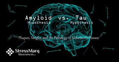 Amyloid Hypothesis vs Tau Hypothesis scientific