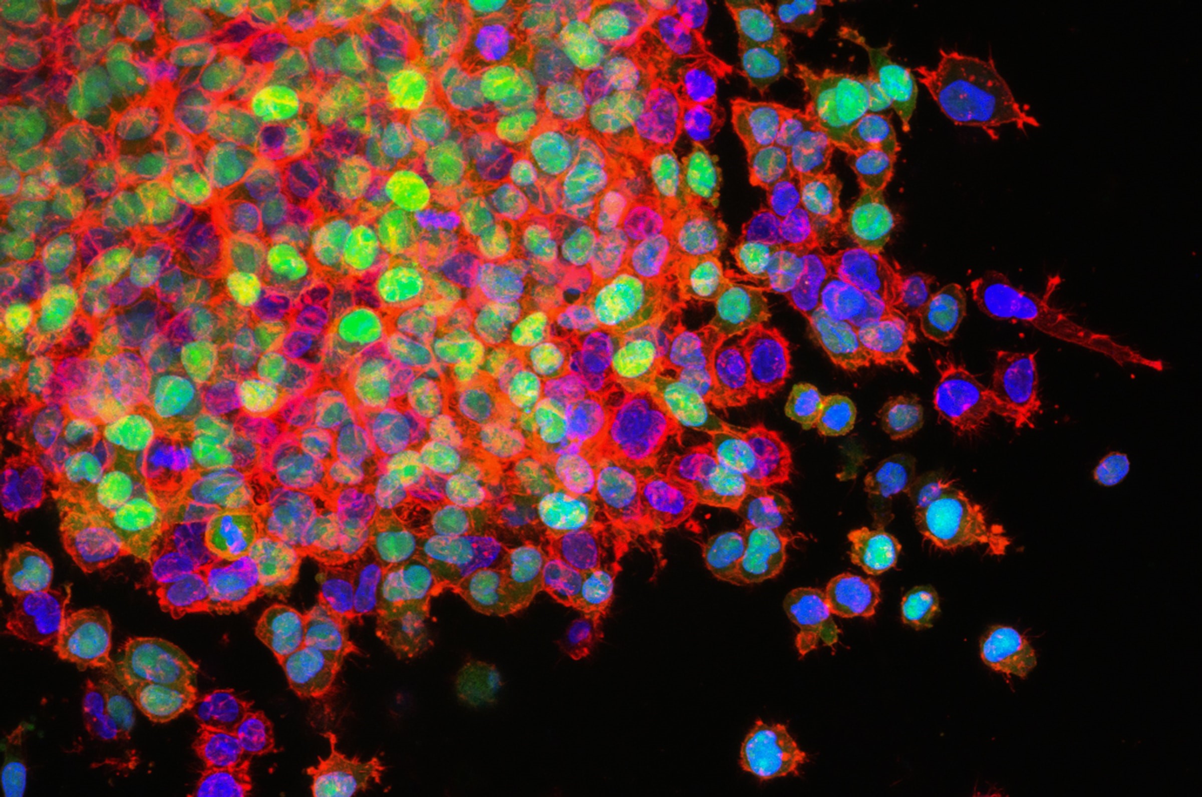 Lilly to Expand Oncology Capabilities with POINT Biopharma Acquisition