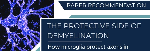 Demyelination